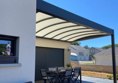 Pergola toile morbihan